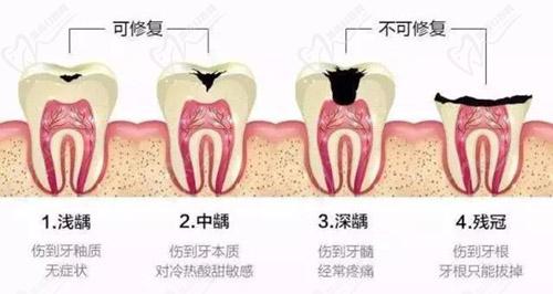 牙齒修復