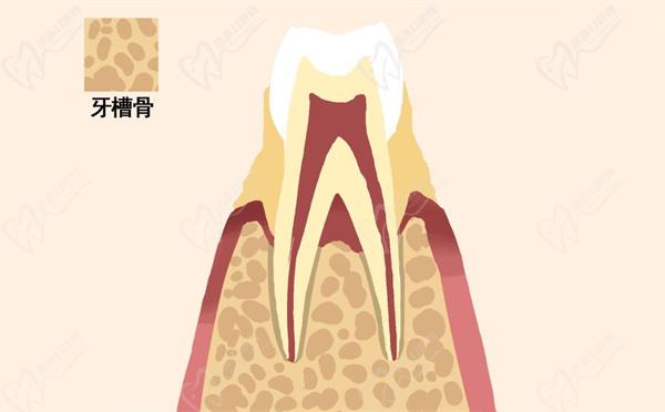 矯正牙根吸收