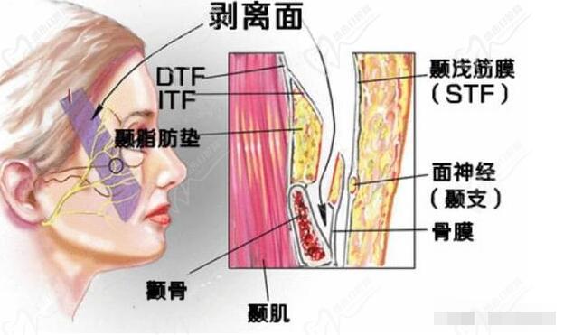 杜太超醫(yī)生的拉皮手術(shù)價(jià)格