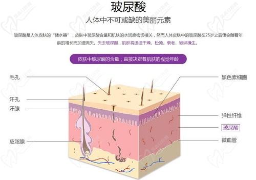 潤(rùn)洛薇玻尿酸適合打哪里