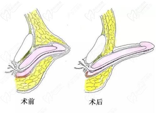 程開(kāi)祥和李世榮誰(shuí)厲 害