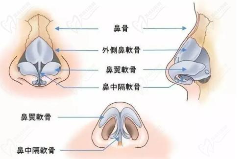 武漢中翰整形付毅醫(yī)生做鼻子口碑不錯