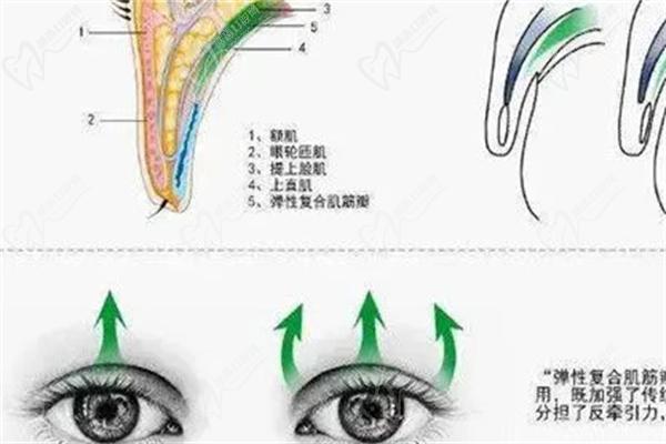 上海佀同帥醫(yī)生做雙眼皮怎么樣