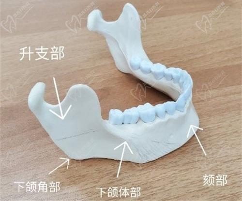 李獻和醫(yī)生磨骨改臉型價格