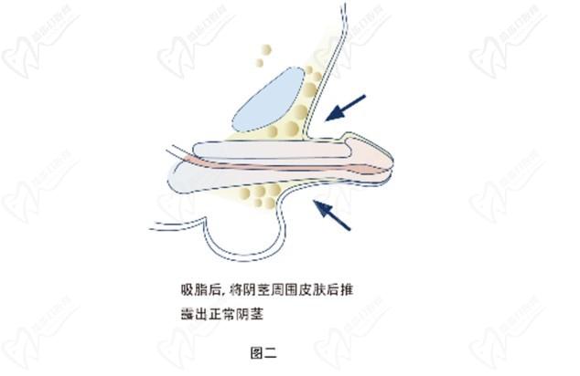 重慶李世榮教授坐診時(shí)間及在線預(yù)約開啟！想“變強(qiáng)”做男科手術(shù)找李世榮男性健康管理中心準(zhǔn)沒錯(cuò)